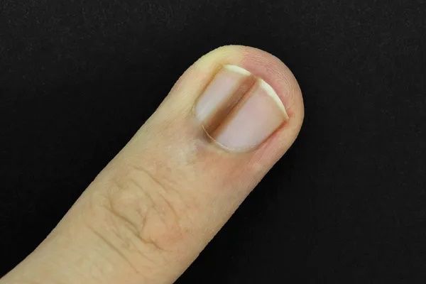 Khi ung thư da tìm đến bạn, cơ thể xuất hiện 7 dấu hiệu cảnh báo-2