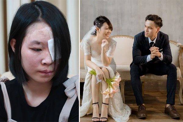 Người phụ nữ bị hãm hại bằng axít: 5 năm vết thương cuồng yêu” chưa lành-3