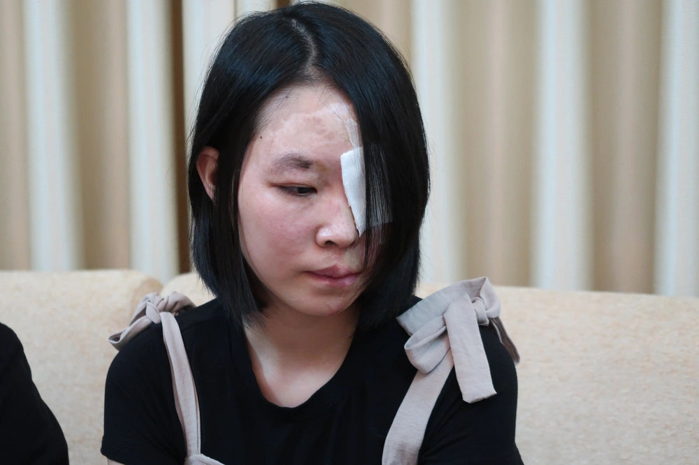 Cô gái bị tạt axit trong cơn ghen ở TP.HCM: 20 lần lên bàn mổ và niềm hạnh phúc vô giá-1