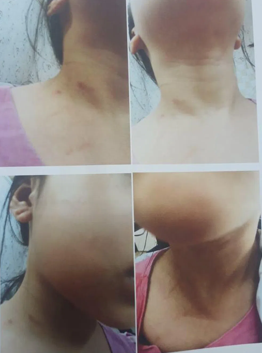 Vụ 2 bé gái nghi bị cha dượng bạo hành ở Hà Nội: Thêm luật sư vào cuộc, công an đang điều tra-2