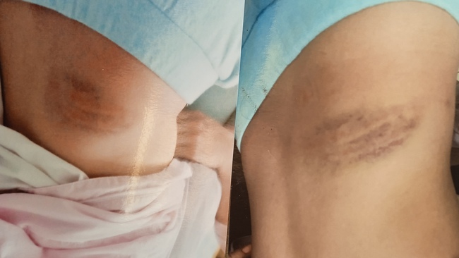 Vụ 2 bé gái nghi bị cha dượng bạo hành ở Hà Nội: Thêm luật sư vào cuộc, công an đang điều tra-3