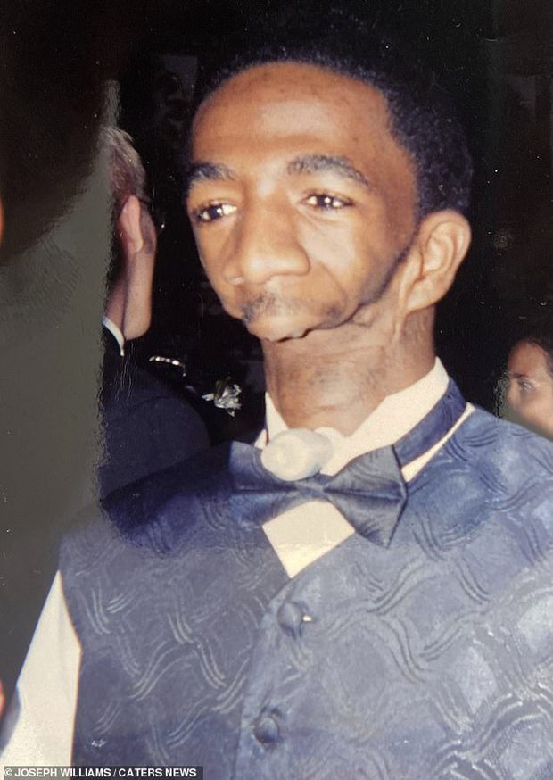 Sinh ra không có hàm, người đàn ông cả đời chưa được ăn uống hay nói chuyện vẫn viết nên chuyện tình cổ tích với người vợ xinh đẹp-4