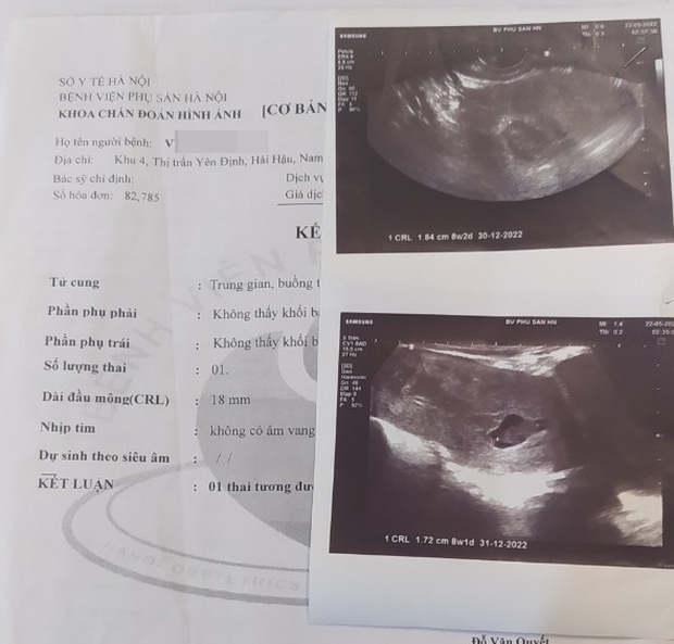 Hà Nội: Điều tra vụ người phụ nữ bị vợ cũ của chồng sắp cưới cùng nhóm đối tượng lạ mặt đánh sảy thai sau bữa tiệc sinh nhật con-5