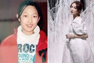 Người phụ nữ Trung Quốc đụng dao kéo 300 lần trong 19 năm