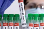 Thông tin về vắc xin tiêm phòng đậu mùa khỉ-2