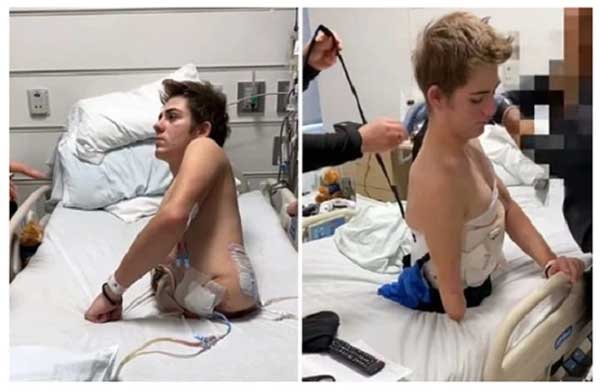 Mất nửa thân dưới sau tai nạn, chàng trai phục hồi thần kỳ và viết nên câu chuyện tình đẹp như mơ với bạn gái-2