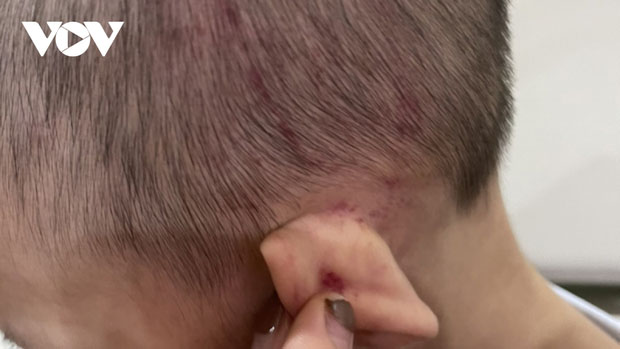 Cháu bé 2 tuổi ở Hải Phòng nghi bị bạo hành tại trung tâm giáo dục chuyên biệt-1