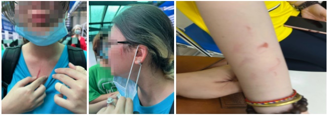 Phụ huynh trường quốc tế ở TP.HCM tố con bị bạn học đánh-1