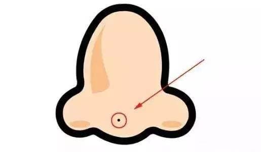 Năm nốt ruồi tài lộc trên cơ thể sẽ trúng quý nhân, dễ được lãnh đạo đánh giá cao, có thể kiếm được nhiều tiền-1