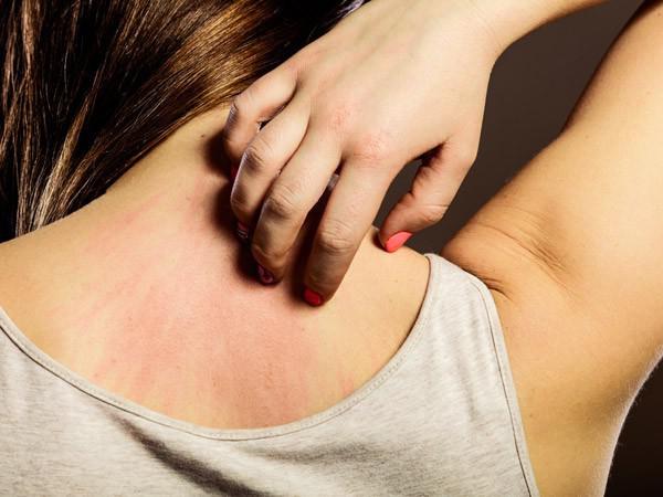 Phụ nữ có gan yếu thường xuất hiện 6 dấu hiệu, chú ý thải độc cơ thể gấp-2