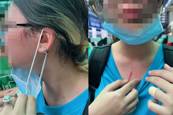 Hiệu trưởng trường quốc tế ở TP.HCM phản hồi thông tin một phụ huynh tố con bị đánh-5