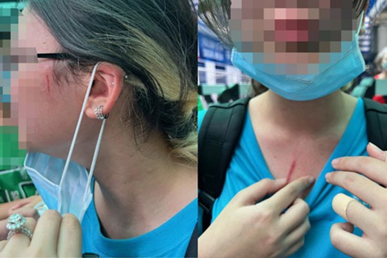 Phụ huynh trường quốc tế tố con bị bạn học đánh, nhà trường chưa xử lý thoả đáng!