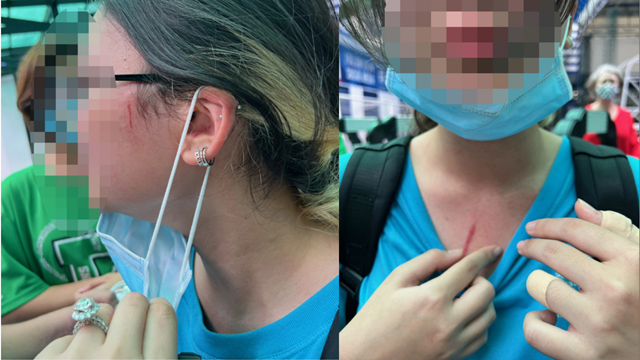 Phụ huynh trường quốc tế tố con bị bạn học đánh, nhà trường chưa xử lý thoả đáng!-1