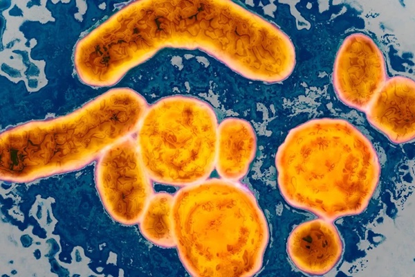 WHO công bố báo cáo mới về làn sóng viêm gan bí ẩn-2