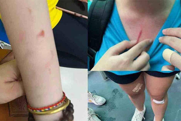 Bộ GDĐT chỉ đạo xử lý vụ việc bạo lực trong học sinh trường quốc tế ở TP.HCM-2