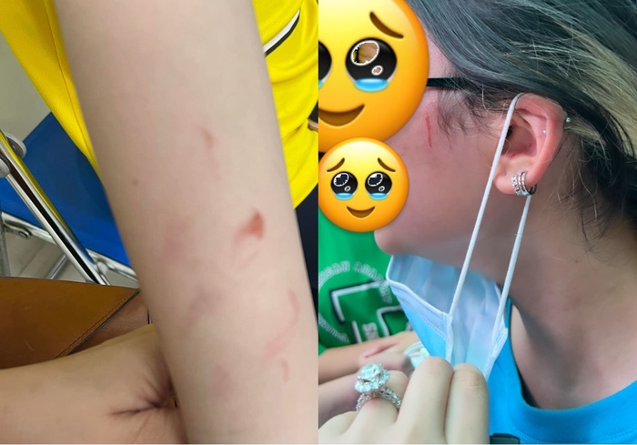 Vụ phụ huynh trường quốc tế tố con gái bị bạn học hành hung: Tạm đình chỉ học 4 em-1