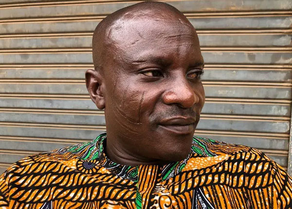 Tập tục rạch mặt tại Nigeria: Khi những vết sẹo trên mặt xác định danh tính và vẻ đẹp của một người-2