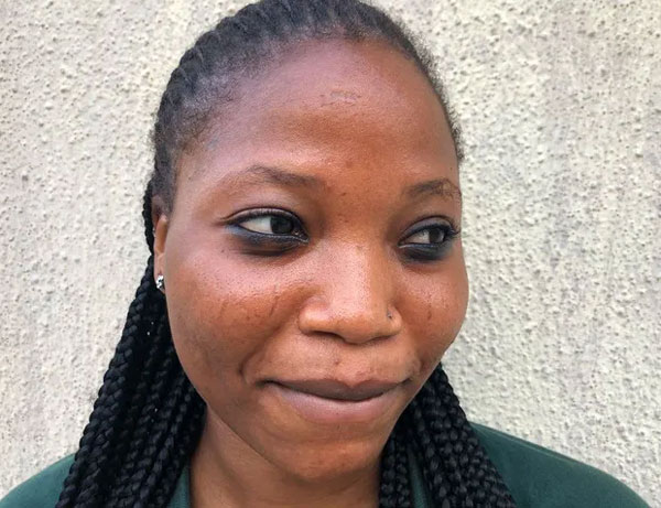 Tập tục rạch mặt tại Nigeria: Khi những vết sẹo trên mặt xác định danh tính và vẻ đẹp của một người-4