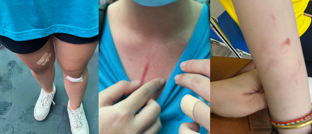 Trường quốc tế ở TP.HCM báo cáo toàn bộ vụ việc học sinh đánh nhau, nhìn nhận có một phần trách nhiệm-2