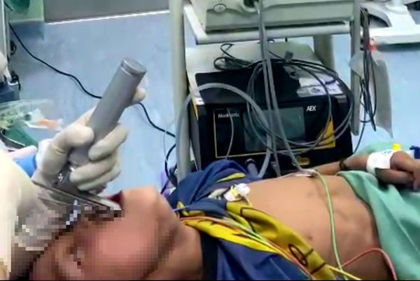 Kinh hãi vắt rừng căng máu ký sinh trong đường thở bé 6 tuổi-1