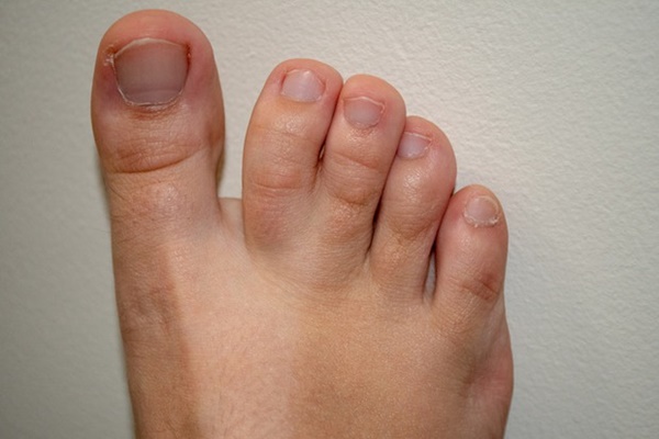 Nếu sở hữu 1 trong 8 đặc điểm này, bạn sẽ thuộc nhóm người đặc biệt nhất trên thế giới-2