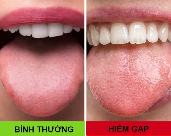Nếu sở hữu 1 trong 8 đặc điểm này, bạn sẽ thuộc nhóm người đặc biệt nhất trên thế giới-4