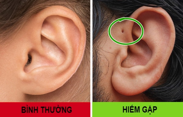 Nếu sở hữu 1 trong 8 đặc điểm này, bạn sẽ thuộc nhóm người đặc biệt nhất trên thế giới-8