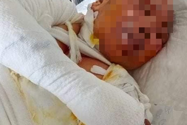 Công nhân tử vong sau trận đòn hội đồng-2