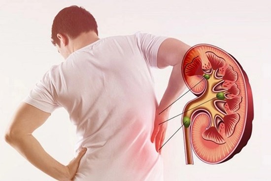 Những thói quen sai lầm dẫn đến suy thận