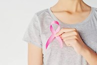 Dấu hiệu trên da cảnh báo loại ung thư phổ biến ở phụ nữ