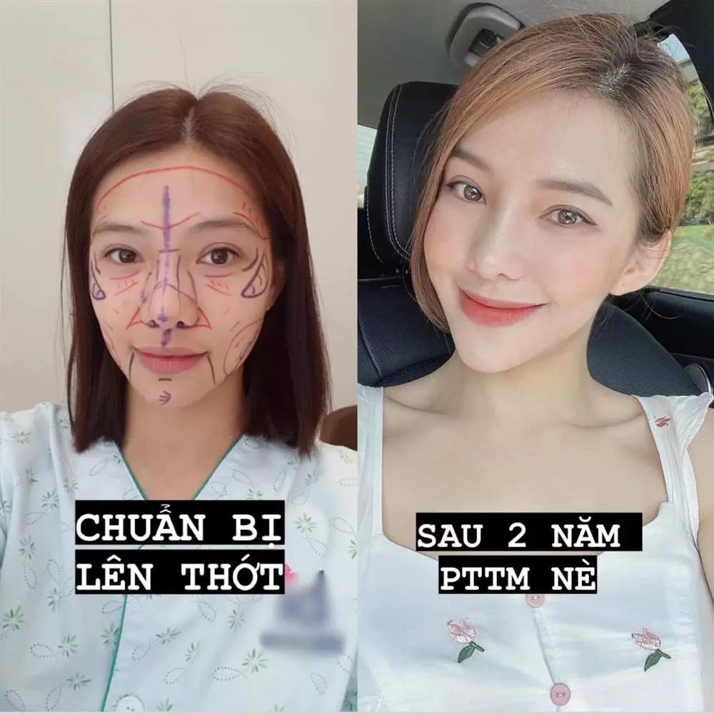 Hãi hùng Lưu Đê Ly bị nước sôi đổ vào người, cánh tay nát tươm-11