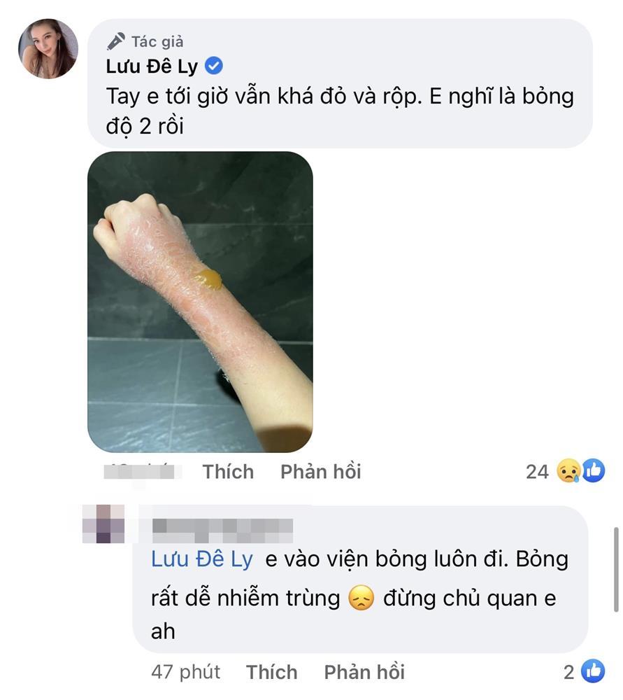 Hãi hùng Lưu Đê Ly bị nước sôi đổ vào người, cánh tay nát tươm-6