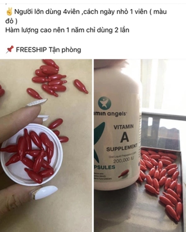 Điều gì xảy ra khi tự ý mua vitamin A liều cao cho trẻ uống?-1