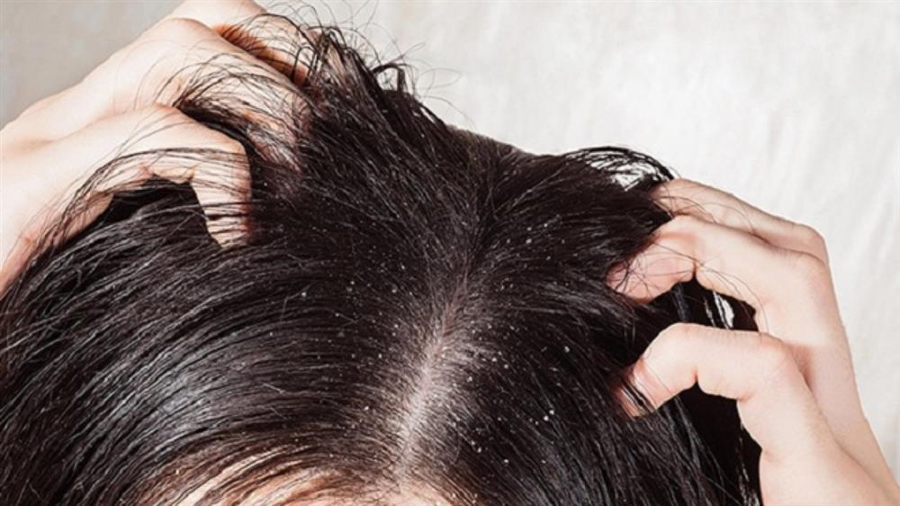 Tóc nhanh bết do đâu và làm sao để khắc phục tình trạng đầu vừa gội đã bết-5