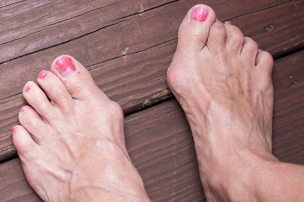 Tế bào ung thư nhen nhóm xuất hiện khi đôi chân của bạn xuất hiện 3 dấu hiệu sau, mong rằng bạn không có điều nào-1