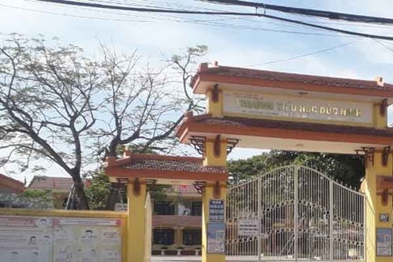Anh trai tâm thần 
