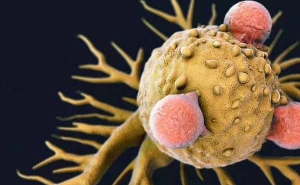 Tế bào ung thư sợ nhất 7 loại rau quả này, toàn thứ rẻ bèo ai cũng có thể ăn-1