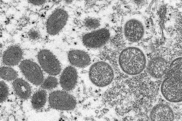 Chủng virus đậu mùa khỉ có 47 đột biến mới-1