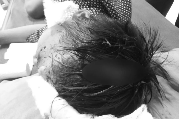 Clip: Chó hoang hung hăng lao tới cắn bé trai và màn giải cứu gay cấn-1