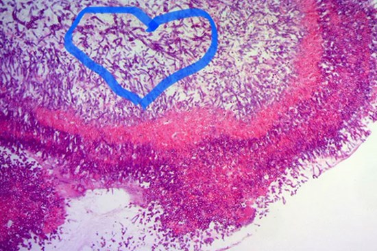 Người đàn ông Hà Nội tử vong sau khi ăn món 