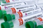 WHO: Biểu hiện lâm sàng của bệnh đậu mùa khỉ đã thay đổi-3