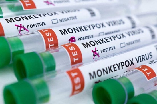 WHO ghi nhận ít nhất 780 trường hợp đậu mùa khỉ ở 27 quốc gia chưa lưu hành bệnh