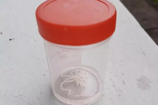 Giun dài 8cm kéo ra từ tay của người đàn ông có sở thích ăn quen thuộc