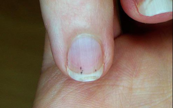 Nếu có 9 triệu chứng có thể trái tim của bạn đang cầu cứu-2