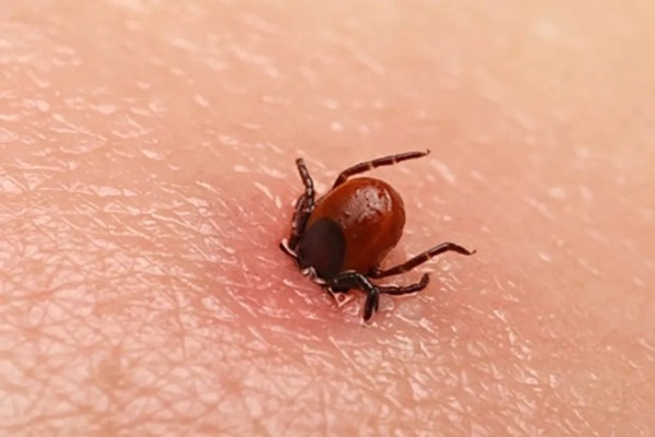 Loại virus có thể gây tử vong tới 40% chỉ sau cơn sốt-1