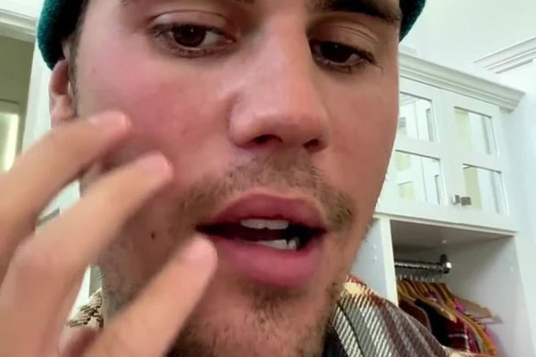 Bệnh tật bủa vây vợ chồng Justin Bieber trong năm 2022-13