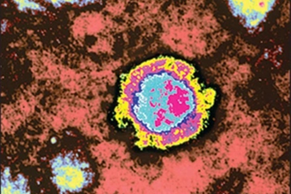Virus hiếm gây tử vong gần 100% tái xuất-1