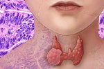 Loại vi khuẩn được ví như bậc thầy gây ung thư: Ung thư đường tiêu hóa, vòm họng đều có liên quan-5