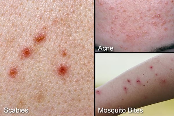 Hà Nội mưa ngập thường xuyên, nhiều người sẽ phải đương đầu với một loại sinh vật-3