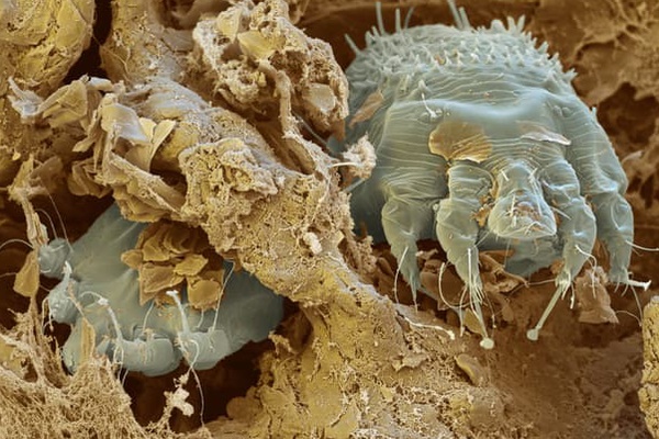 Hà Nội mưa ngập thường xuyên, nhiều người sẽ phải đương đầu với một loại sinh vật-4